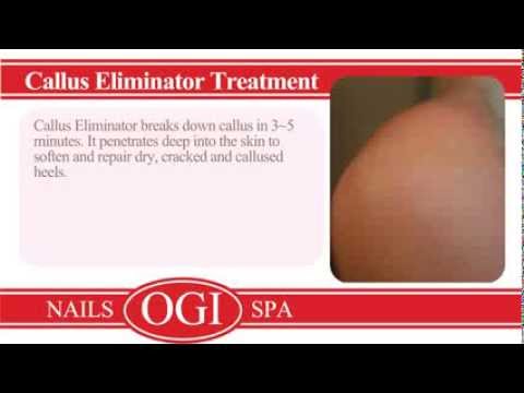 OGI Callus Eliminator