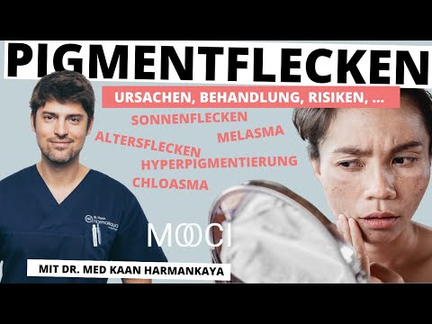 Pigmentflecken entfernen - Ursachen, Behandlung, Risiken
