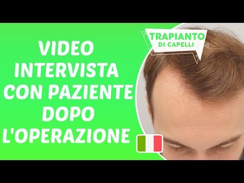 Trapianto Capelli in Turchia - Video Intervista con Paziente dopo l'Operazione - Dr. Hamid AYDIN
