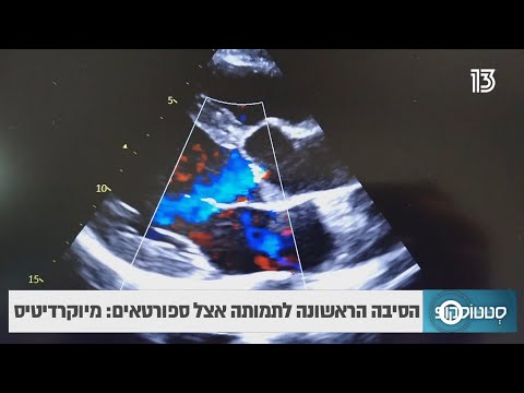 הבדיקות שיכולות להציל אתכם ממיוקרדיטיס (דלקת בשריר הלב)