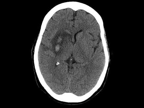 Intracranial Hemorrhage Detection | Images are grouped by diagnosis.