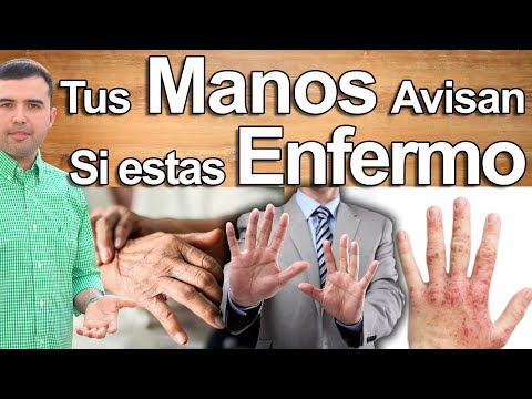 6 Health Problems Your Hands Warn You About - Diabetes, Liver, Arthritis, Thyroid, Anemia