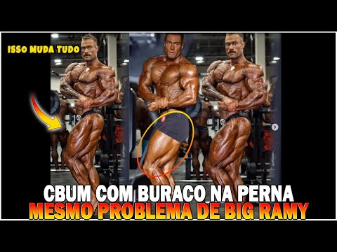 CBUM APPEARS WITH A GIANT HOLE IN HIS LEG AND FANS SAY HE TOOK A CLASS WITH BIG RAMY