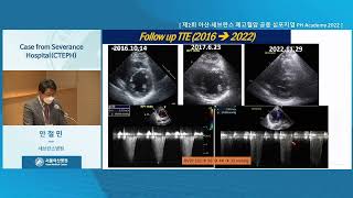 제2회 아산·세브란스 <b>폐</b>고혈압 공동 심포지엄 PH Academy 2022 : Case from Severance Hospital(CTEPH) 미리보기 썸네일