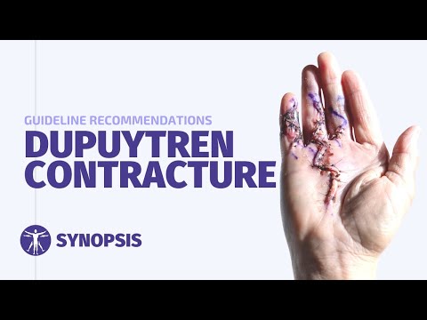 Dupuytren's Contracture Guideline | SYNOPSIS