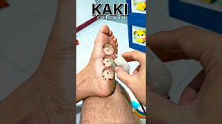 Download lagu What is ❗Plug Legs ❗Here's How to Make It ❗#editing #illustration mp3 Download lagu What is ❗Plug Legs ❗Here's How to Make It ❗#editing #illustration mp3