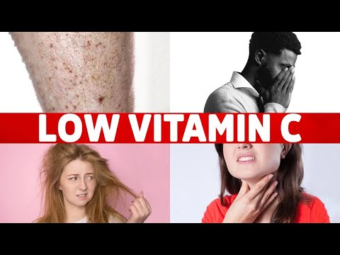 8 Signs of a Vitamin C Deficiency You've Never Heard About