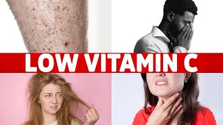 8 Signs of a Vitamin C Deficiency You