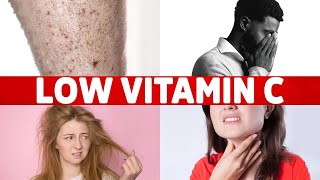 8 Signs of a Vitamin C Deficiency You&#39;ve Never Heard About