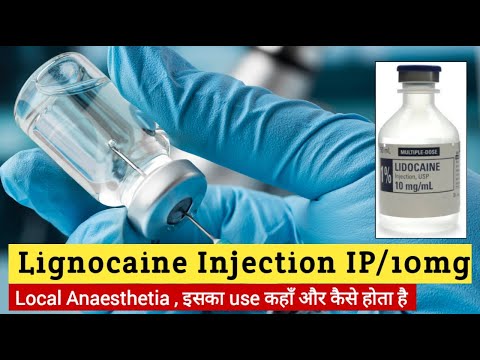 Lignocaine Hydrochloride Gel