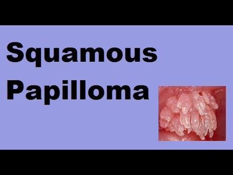 légzési papillomatosis hisztopatológia alom férgekkel