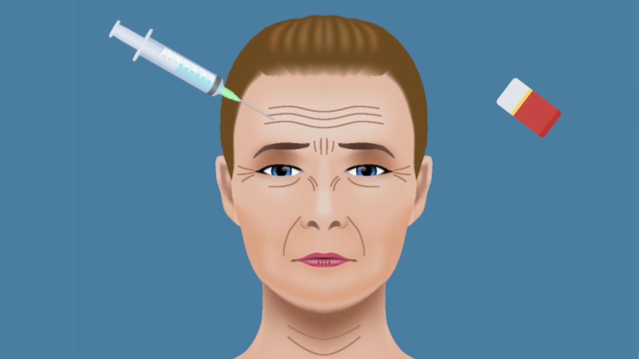 Botox Blunders: What to Avoid