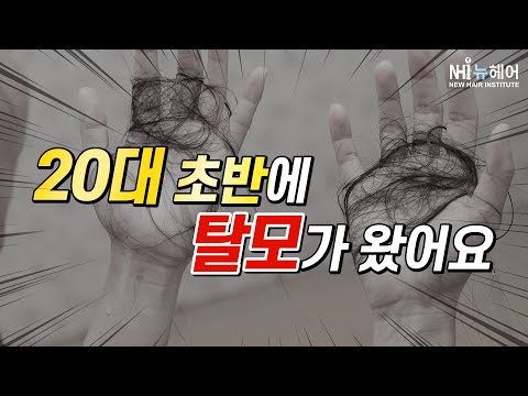 탈모가 20대 초반에 찾아 왔어요 - 뉴헤어 I 탈모치료