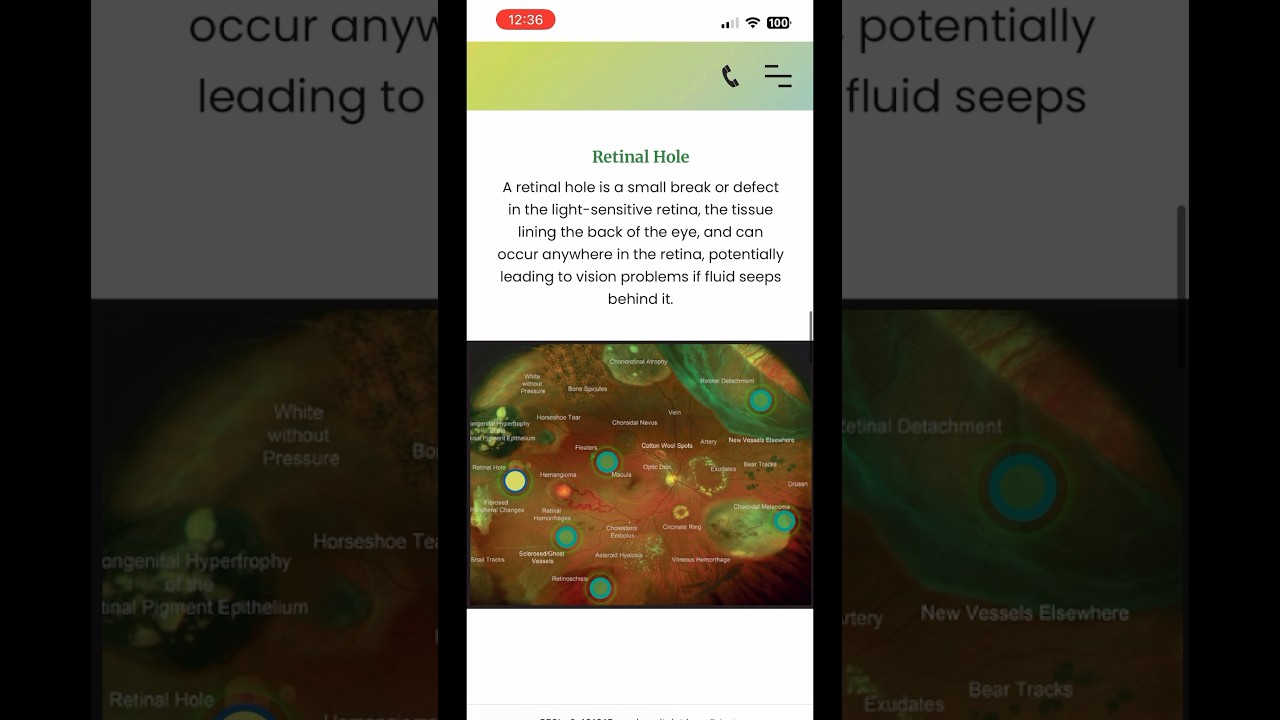 Eye Anatomy Infographics #optometry #eye #optometrist