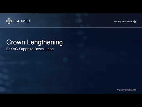 Crown Lengthening with SAPPHIRE Dental Laser