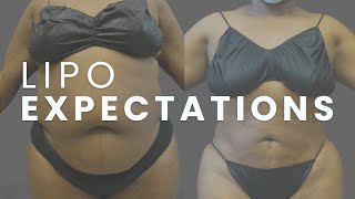 Setting expectations for your SONOBELLO experience! | Dr. Nathan Miller