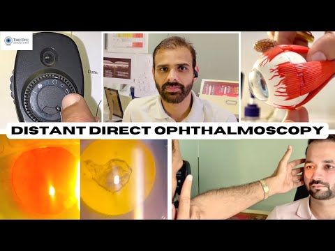 Distant Direct Ophthalmoscopy