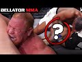 TOP Arm Breaking Finishes l BELLATOR MMA