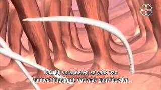 Hookworms in Cats | Pharmacy4pets.com