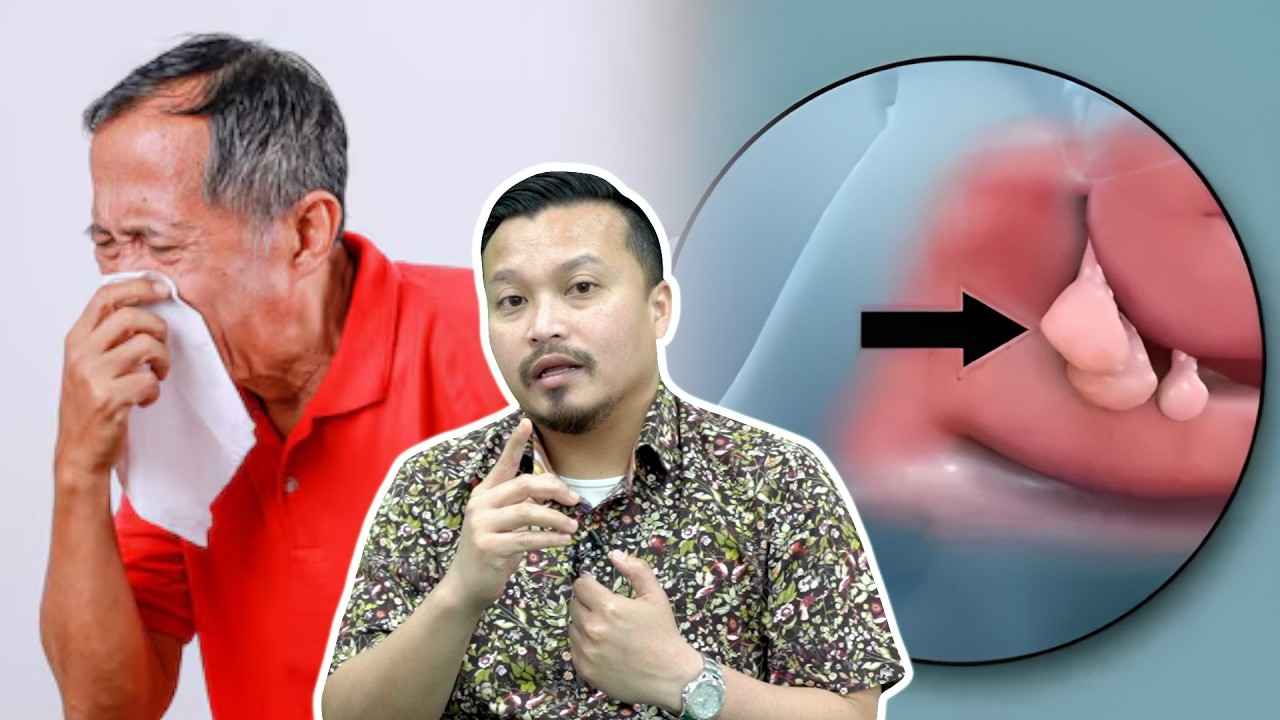 Ini Punca Kanser Hidung