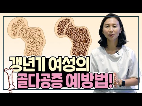골다공증에는 증상이 없다?? (골다공증의 모든 것)