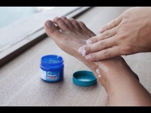 Ekzoderil el ungüento la eflorescencia Ekzifin la crema al hongo de la uña