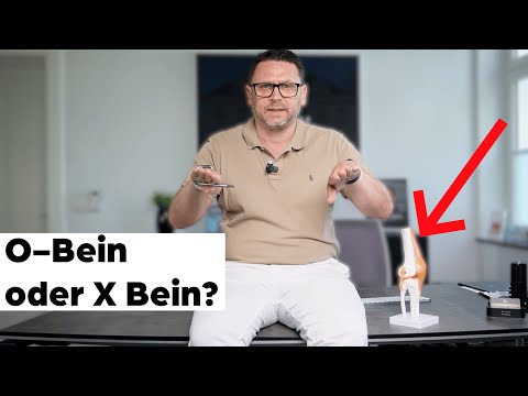 Wann muss das Knie operiert werden bei O-Bein bzw X-Bein?