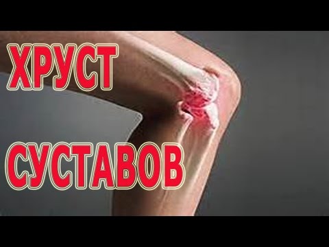 Arthrose des Hüftgelenks hondroprotektory ICD Brustwirbelsäule Prellung Code