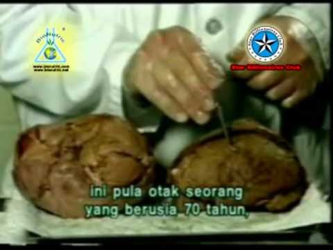 Minum bir dan potensi Potensi obat untuk potensi