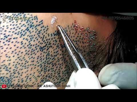 download lagu mp3 mp4 Beard Operation, download mp3 Beard Operation free downloadn, video klip Beard Operation