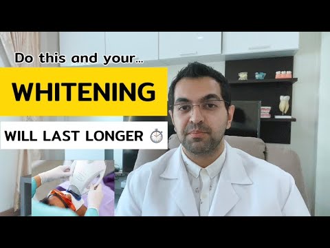 1st YouTube video about how long after zoom whitening can i drink coffee