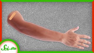 What If Your Arm Falls Off Right After a Vaccine?