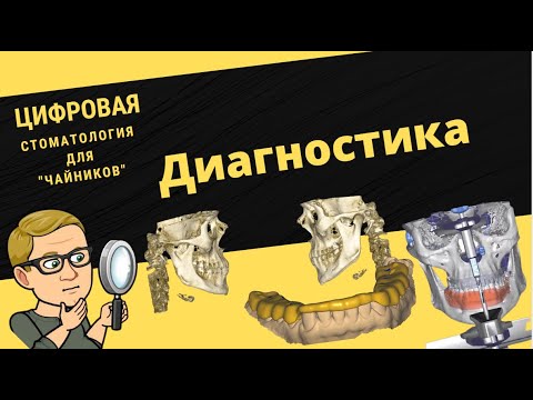 Цифровая стоматология для чайников. 5 серия. Диагностика.