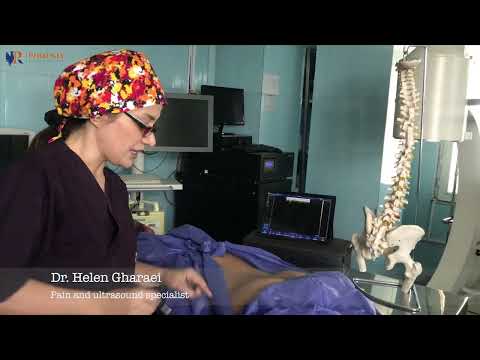 Ultrasound Guided Sacroiliac Joint injection