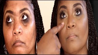 HOW TO: Makeup for dark under eye circles & sunken eyes | Darbiedaymua