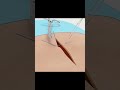Sutures and Suturing techniques #surgery#shorts#anatomy