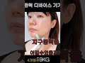 더마 ems샷 디바이스 기 내돈내산 리얼 리뷰 shorts