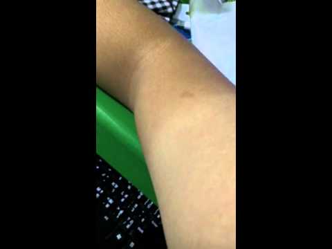 กล้ามเนื้อแขนขวากระตุกครับ.. - Pantip กล้ามเนื้อแขนขวากระตุกครับ.. - Pantip
