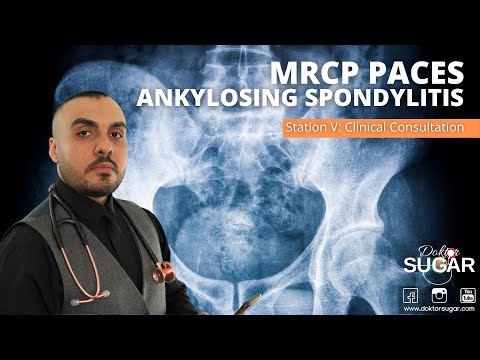 MRCP PACES - Station 5 - Ankylosing Spondylitis