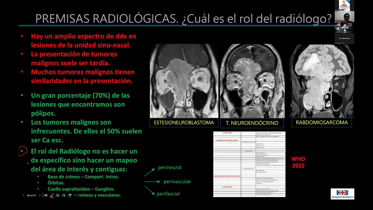 VI Conferencia Científica Mensual de Radiología 2024- Capítulo Neurorradiología