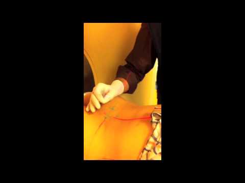 CT-gesteuerte Schmerztherapie