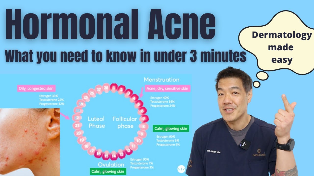 Hormonal acne explained in under 3 minutes | Dermatologist reviews