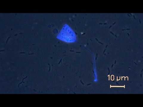 Bicosoeca - a genus of flagellates  with vase-like lorica.