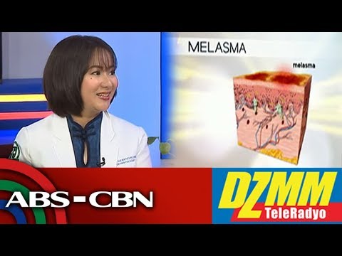Paano nagkakaroon ng pekas ang tao? | DZMM