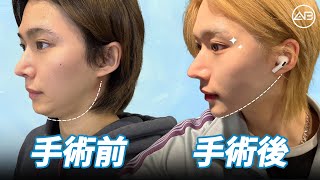  男性整形のリアル。二重あごをなくす方法とは？ | AB美容整形