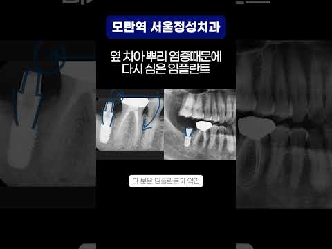 땡큐성형외과 Clips