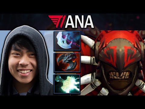 Bloodseeker Dota 2 7.32 Gameplay T1.Ana with 20 Kills and Manta Style #dota2 #dota2gameplay