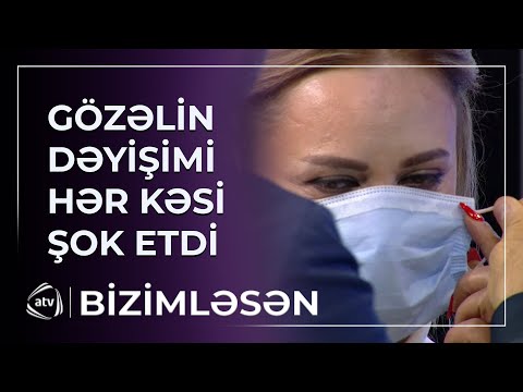 Estetik əməliyyat olunan Gözəlin dəyişimi hər kəsi ŞOKA SALDI