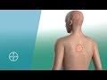 How Aspirin Works