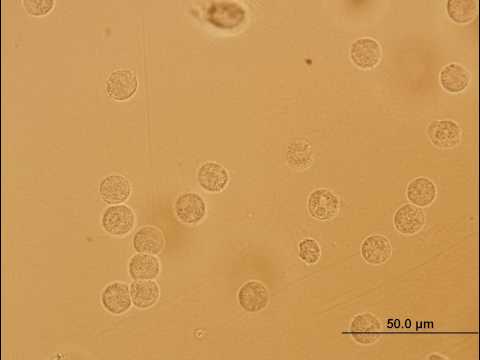 Duke ProstataMassager Behandlung von Prostatakrebs in Irkutsk